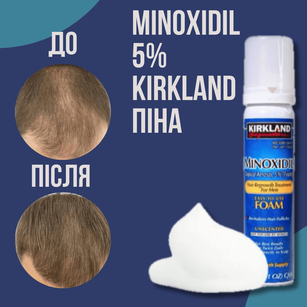 Піна проти випадіння волосся Kirkland міноксиділ 5%, 60 мл 4 фото